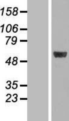 Western Blot: MINA Overexpression Lysate [NBL1-13111]