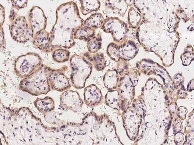 Immunohistochemistry-Paraffin: MINDY2 Antibody [NBP3-06279]