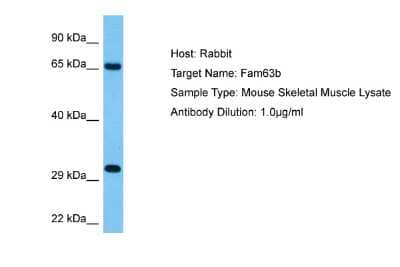 Western Blot: MINDY2 Antibody [NBP2-85287]