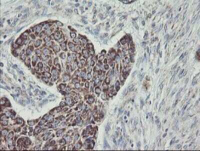 Immunohistochemistry: MINOS1 Antibody (OTI4H7) [NBP2-45550]