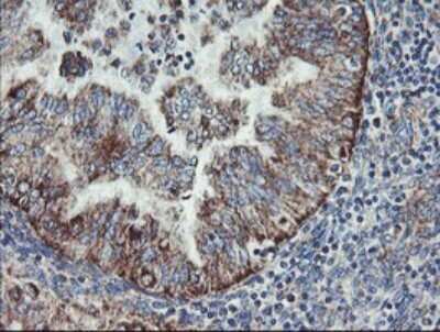 Immunohistochemistry: MINOS1 Antibody (OTI4H7) [NBP2-45550]