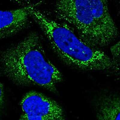 Immunocytochemistry/ Immunofluorescence: MINOS1 Antibody [NBP2-31802]