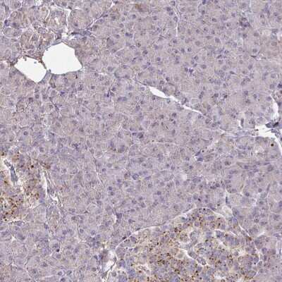 Immunohistochemistry-Paraffin: MINOS1 Antibody [NBP2-31802]