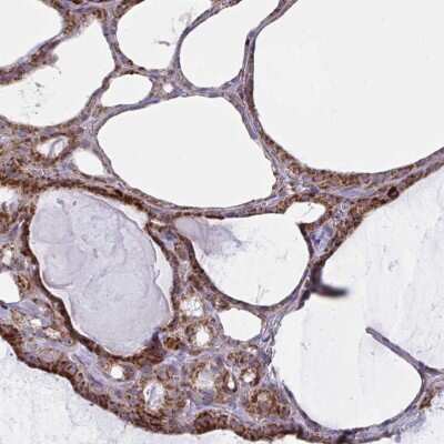 Immunohistochemistry-Paraffin: MINOS1 Antibody [NBP2-31802]