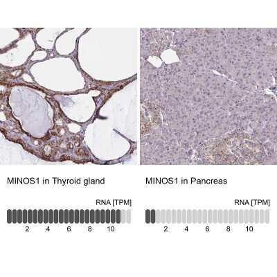 Immunohistochemistry-Paraffin: MINOS1 Antibody [NBP2-31802]