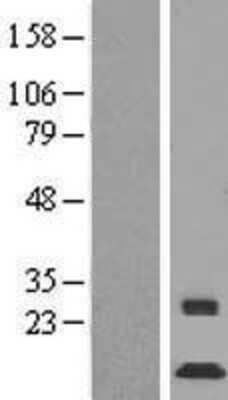 Western Blot: MINOS1 Overexpression Lysate [NBP2-11608]