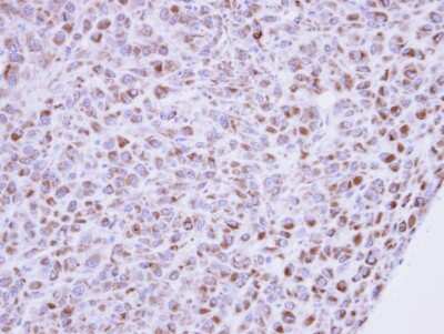 Immunohistochemistry-Paraffin: MINPP1 Antibody [NBP1-32872]