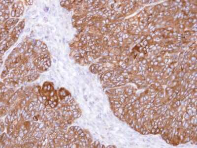 Immunohistochemistry-Paraffin: MINPP1 Antibody [NBP1-33491]