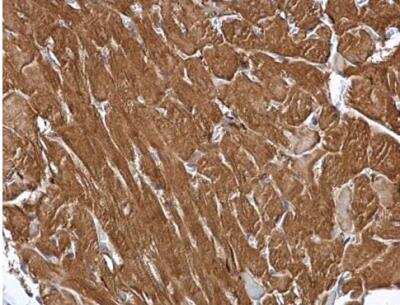 Immunohistochemistry-Paraffin: MINPP1 Antibody [NBP1-33491]