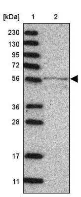 Western Blot: MINPP1 Antibody [NBP1-82644]