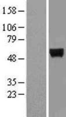 Western Blot: MINPP1 Overexpression Lysate [NBL1-13113]