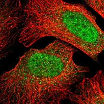 Immunocytochemistry/ Immunofluorescence: MIOS Antibody [NBP2-56732]