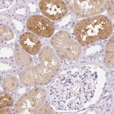 Immunohistochemistry-Paraffin: MIOX Antibody [NBP2-31975]