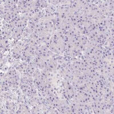 Immunohistochemistry-Paraffin: MIOX Antibody [NBP2-31975]