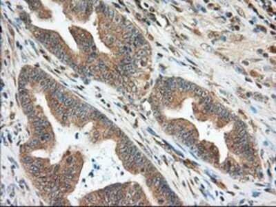 Immunohistochemistry: MIOX Antibody (OTI4G7) - Azide and BSA Free [NBP2-72697]