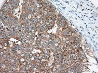 Immunohistochemistry: MIOX Antibody (OTI4G7) - Azide and BSA Free [NBP2-72697]