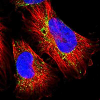 Immunocytochemistry/ Immunofluorescence: MIPEP Antibody [NBP1-82645]