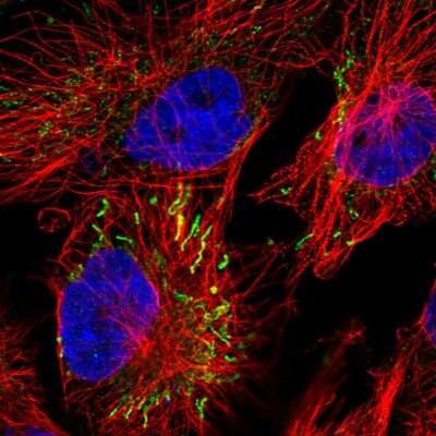 Immunocytochemistry/ Immunofluorescence: MIPEP Antibody [NBP1-82647]