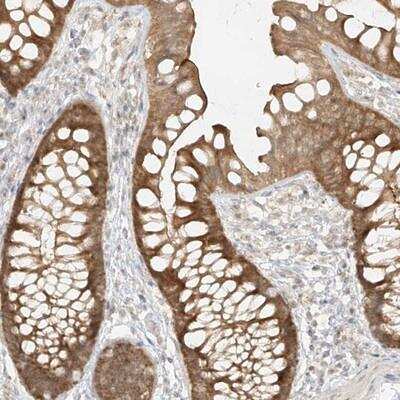 Immunohistochemistry-Paraffin: MIPEP Antibody [NBP1-82646]