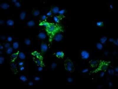 Immunofluorescence: MIPEP Antibody (OTI5E7) [NBP2-45861]