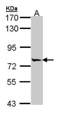 Western Blot: MIPEP Antibody [NBP1-32008]