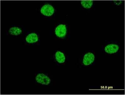 Immunocytochemistry/ Immunofluorescence: MIPOL1 Antibody (1B7) [H00145282-M04]