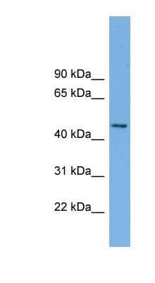 Western Blot: MIPOL1 Antibody [NBP1-57819]