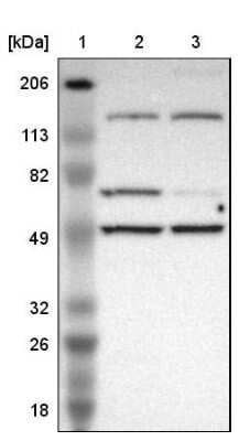 Western Blot: MIPOL1 Antibody [NBP1-86161]