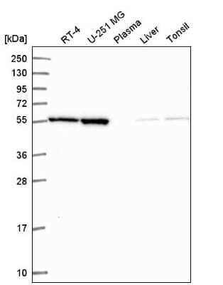 Western Blot: MIPOL1 Antibody [NBP2-55615]