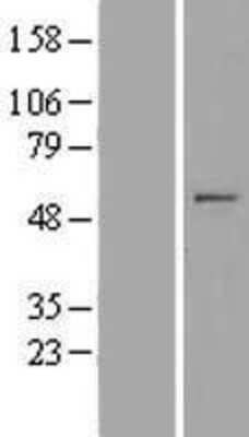 Western Blot: MIPOL1 Overexpression Lysate [NBP2-05636]