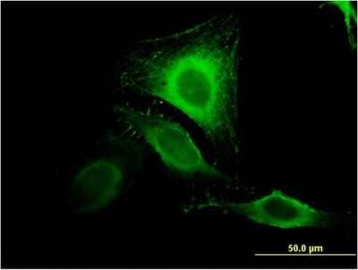 Immunocytochemistry/ Immunofluorescence: MIR16 Antibody (2H6) [H00051573-M04]