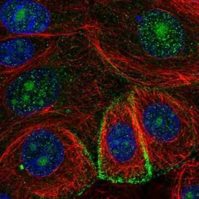 Immunocytochemistry/ Immunofluorescence: MIR16 Antibody [NBP2-57760]