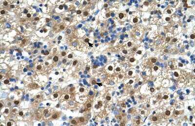 Immunohistochemistry: MIR16 Antibody [NBP1-69654]