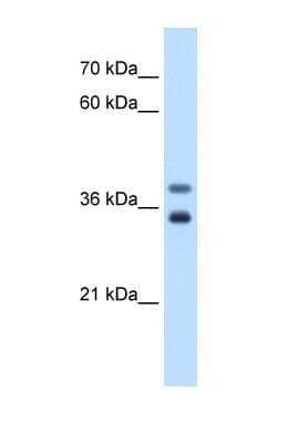 Western Blot: MIR16 Antibody [NBP1-69654]