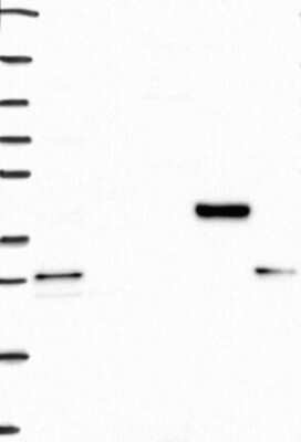 Western Blot: MIR16 Antibody [NBP3-17273]