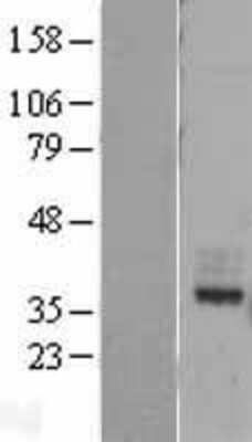 Western Blot: MIR16 Overexpression Lysate [NBL1-11023]