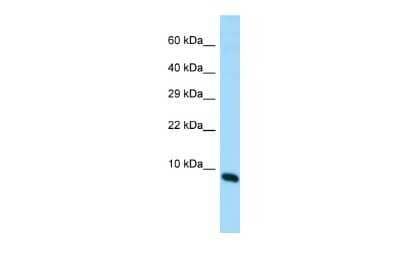 Western Blot: MIR22 host gene Antibody [NBP3-09598]