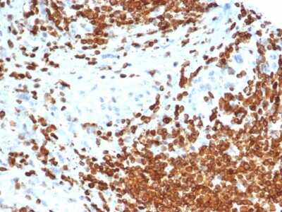 Immunohistochemistry-Paraffin: MIS/AMH Antibody (AMH/6713R) - Azide and BSA Free [NBP3-08459]