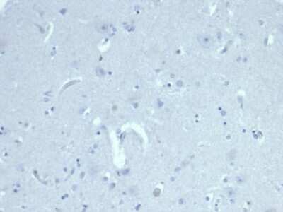Immunohistochemistry-Paraffin: MIS/AMH Antibody (AMH/6713R) - Azide and BSA Free [NBP3-08459]