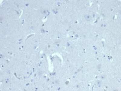 Immunohistochemistry-Paraffin: MIS/AMH Antibody (AMH/6713R) [NBP3-07296]