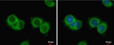 Immunocytochemistry/ Immunofluorescence: MIS/AMH Antibody [NBP2-43670]