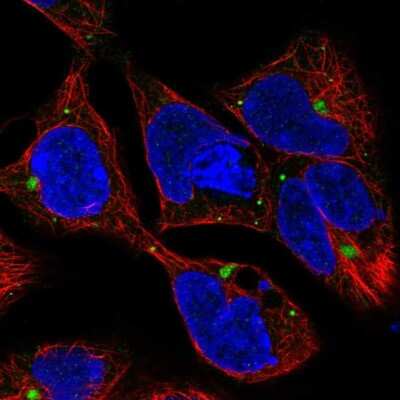 Immunocytochemistry/ Immunofluorescence: MIS/AMH Antibody [NBP2-68847]