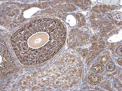 Immunohistochemistry-Paraffin: MIS/AMH Antibody [NBP2-43670]