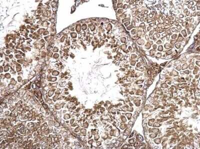 Immunohistochemistry-Paraffin: MIS/AMH Antibody [NBP2-43670]