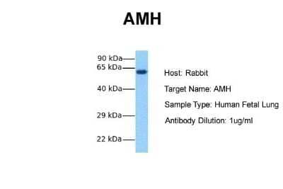 Western Blot: MIS/AMH Antibody [NBP1-70639]