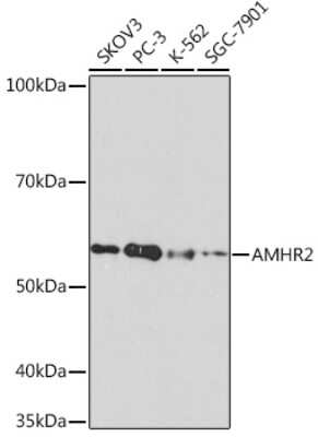 Western Blot: MIS RII/AMHR2 Antibody (8Z8X4) [NBP3-16706]