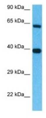 Western Blot: MIS RII/AMHR2 Antibody [NBP3-09957]