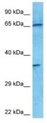 Western Blot: MIS RII/AMHR2 Antibody [NBP3-09975]