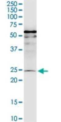 Western Blot: MIS12 Antibody (1G3) [H00079003-M01]