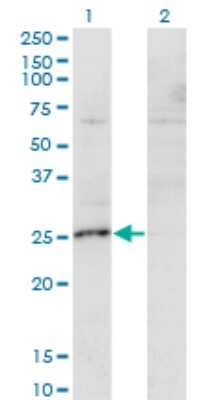 Western Blot: MIS12 Antibody (1G3) [H00079003-M01]